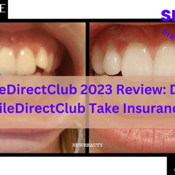 SmileDirectClub 2023 Review: Does SmileDirectClub Take Insurance?